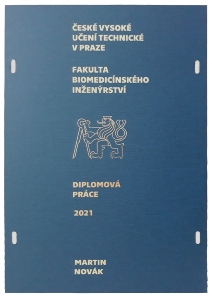 Tkanicové desky - diplomová práce - ČVUT - Fakulta biomedicínského inženýrství - výroba AZ-Diplomky.cz